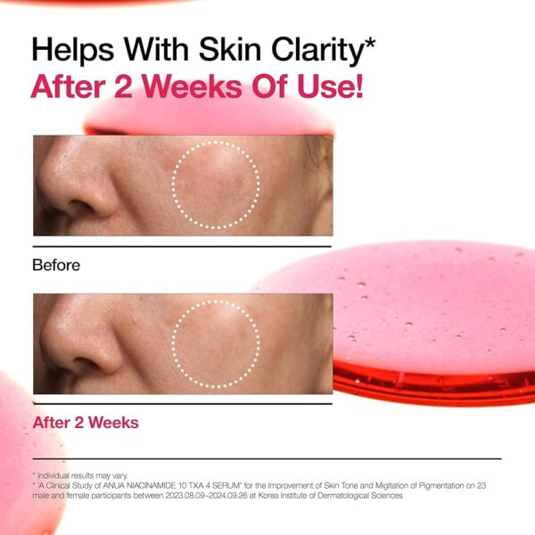 Anua Niacinamide 10% + TXA 4% Dark Spot Correcting Serum - Image 6