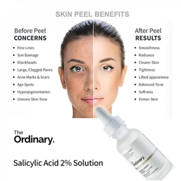 The Ordinary – Niacinamide 10% + Zinc 1% 30 ML - Image 3