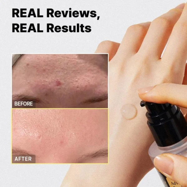 COSRX – Advanced Snail 96 Mucin Power Essence 100ml - Image 2